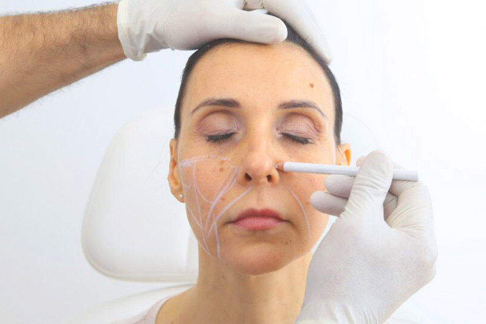 https://web1.drchichakli.com/wp-content/uploads/2018/01/Fadenlifting-Koerper-frau-dr-chichakli-schoenheitschirurgi-wien-shutterstock_447510967.jpg